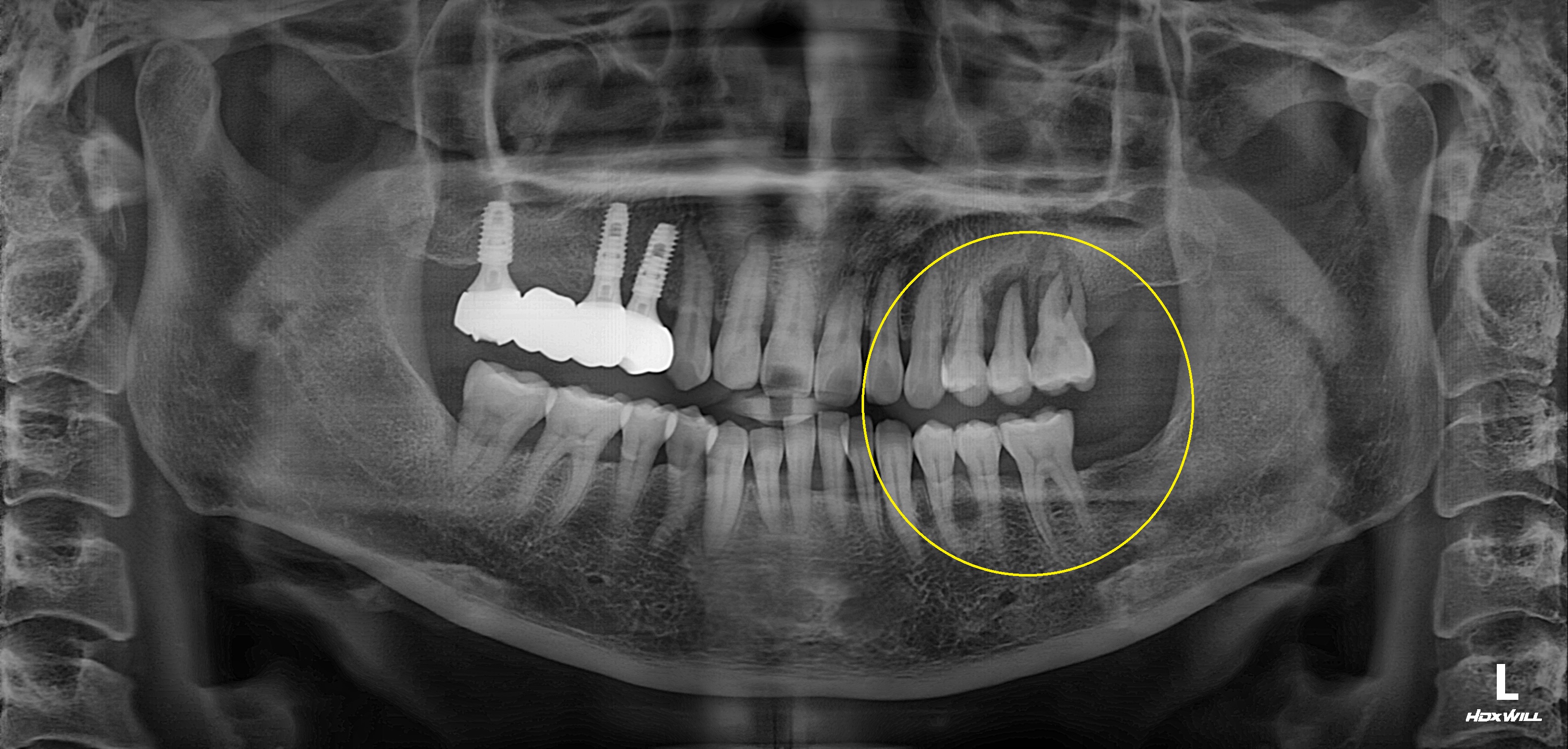 Before Image