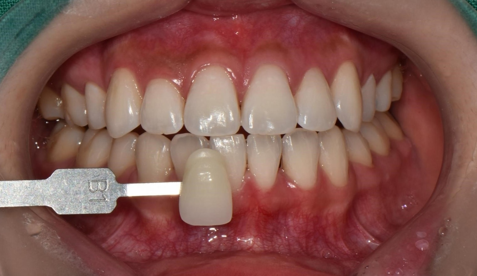 Before Image
