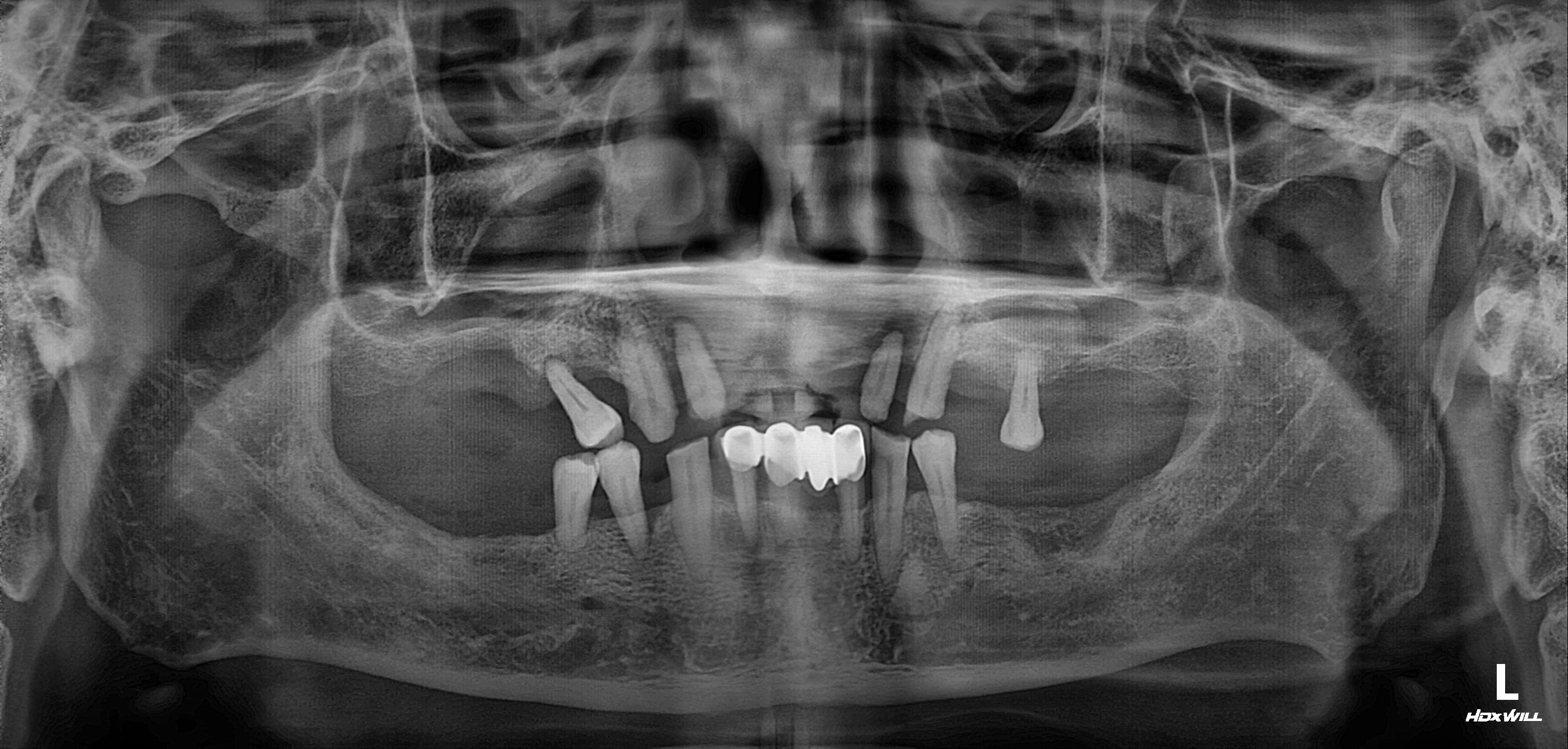 Before Image