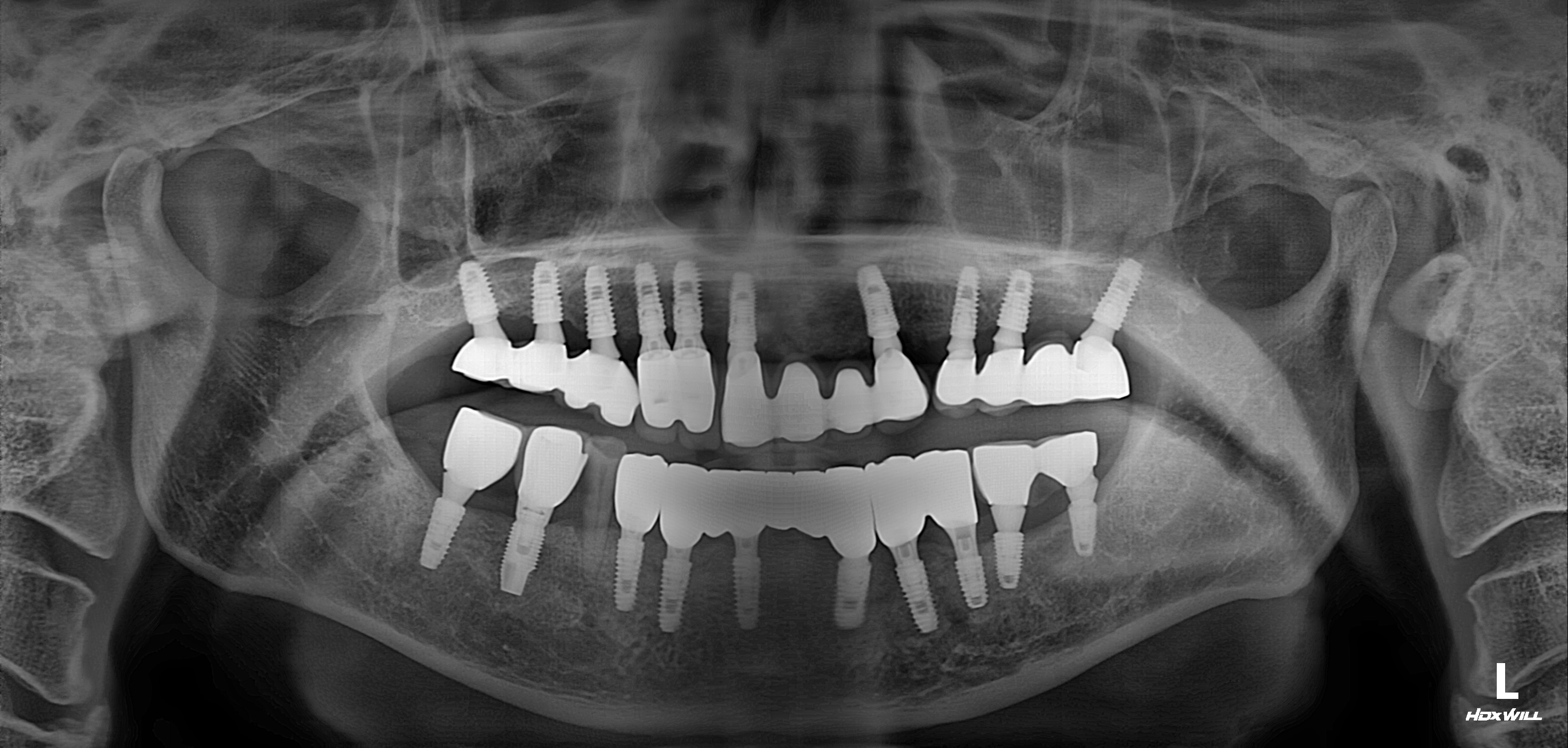 Before Image
