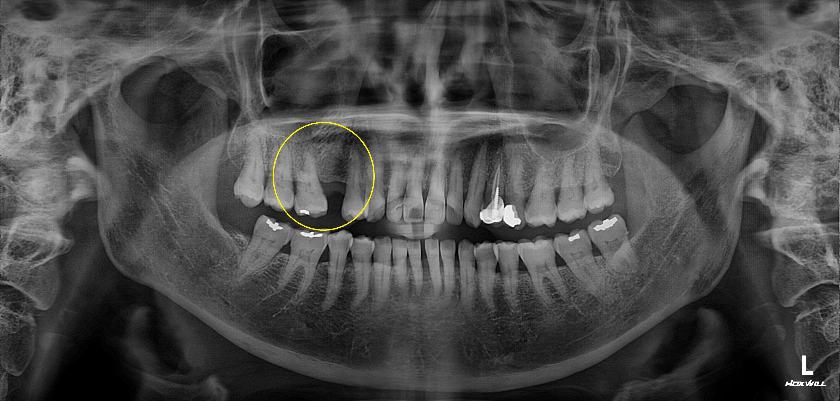 Before Image