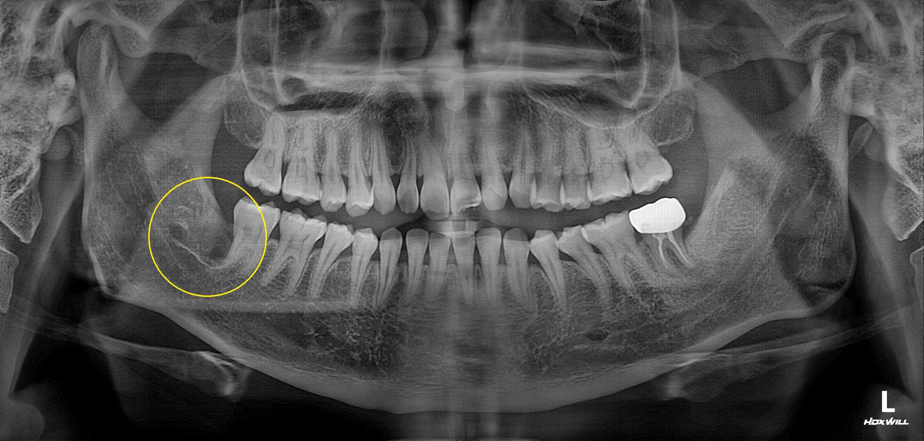 Before Image