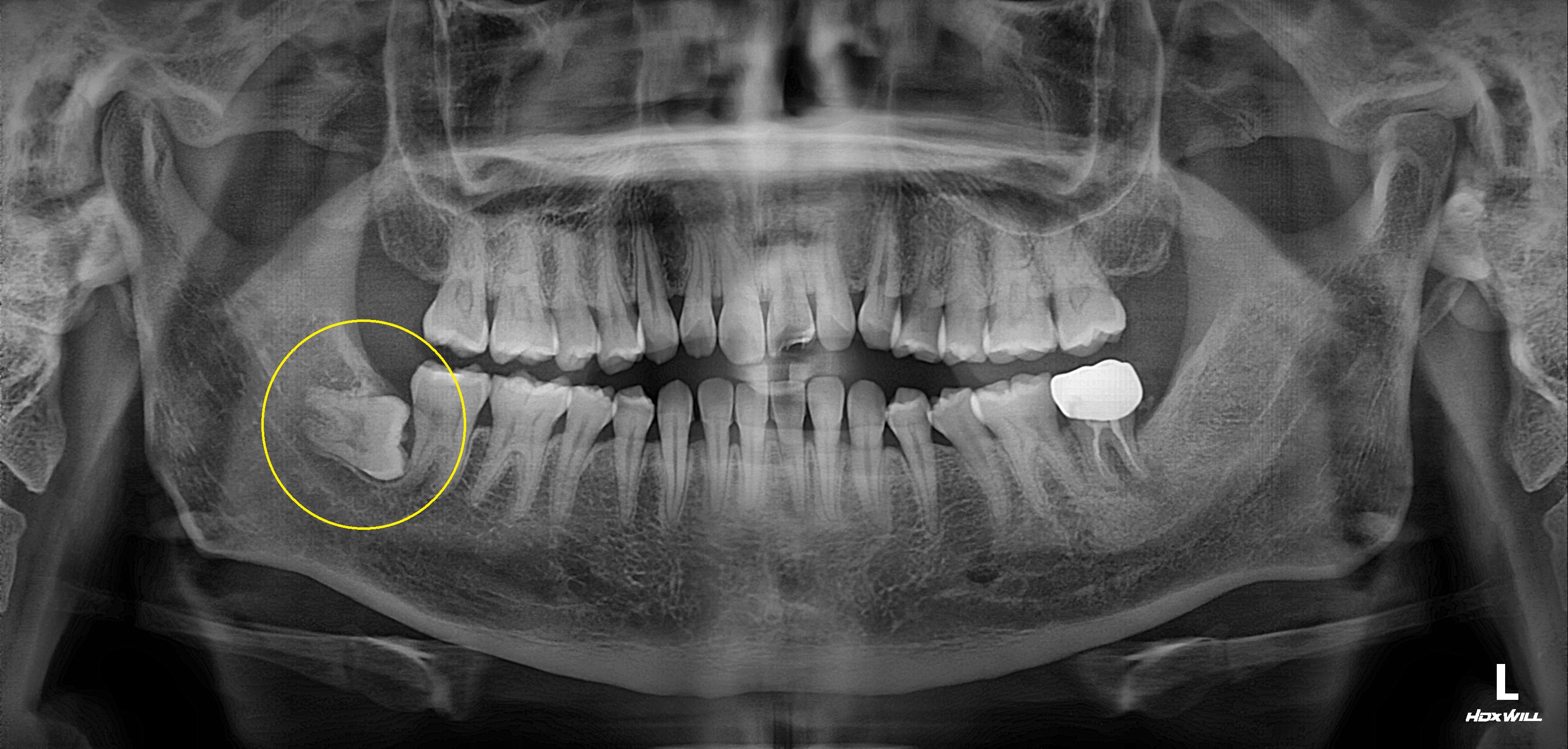 Before Image