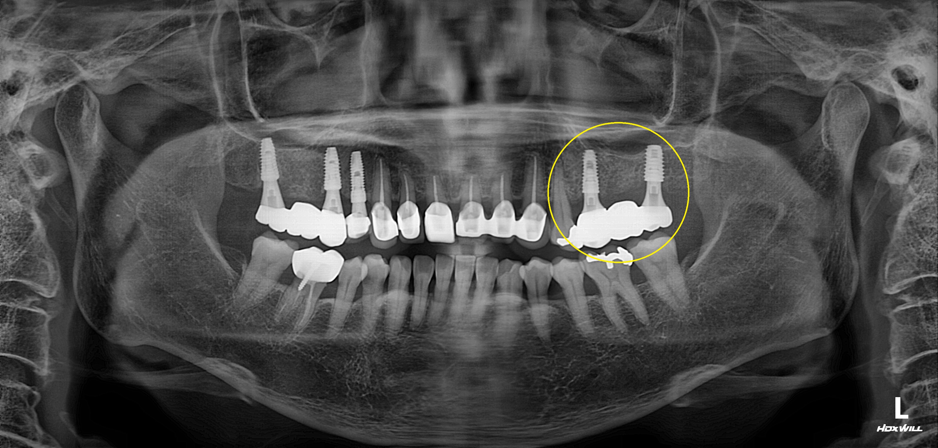 Before Image