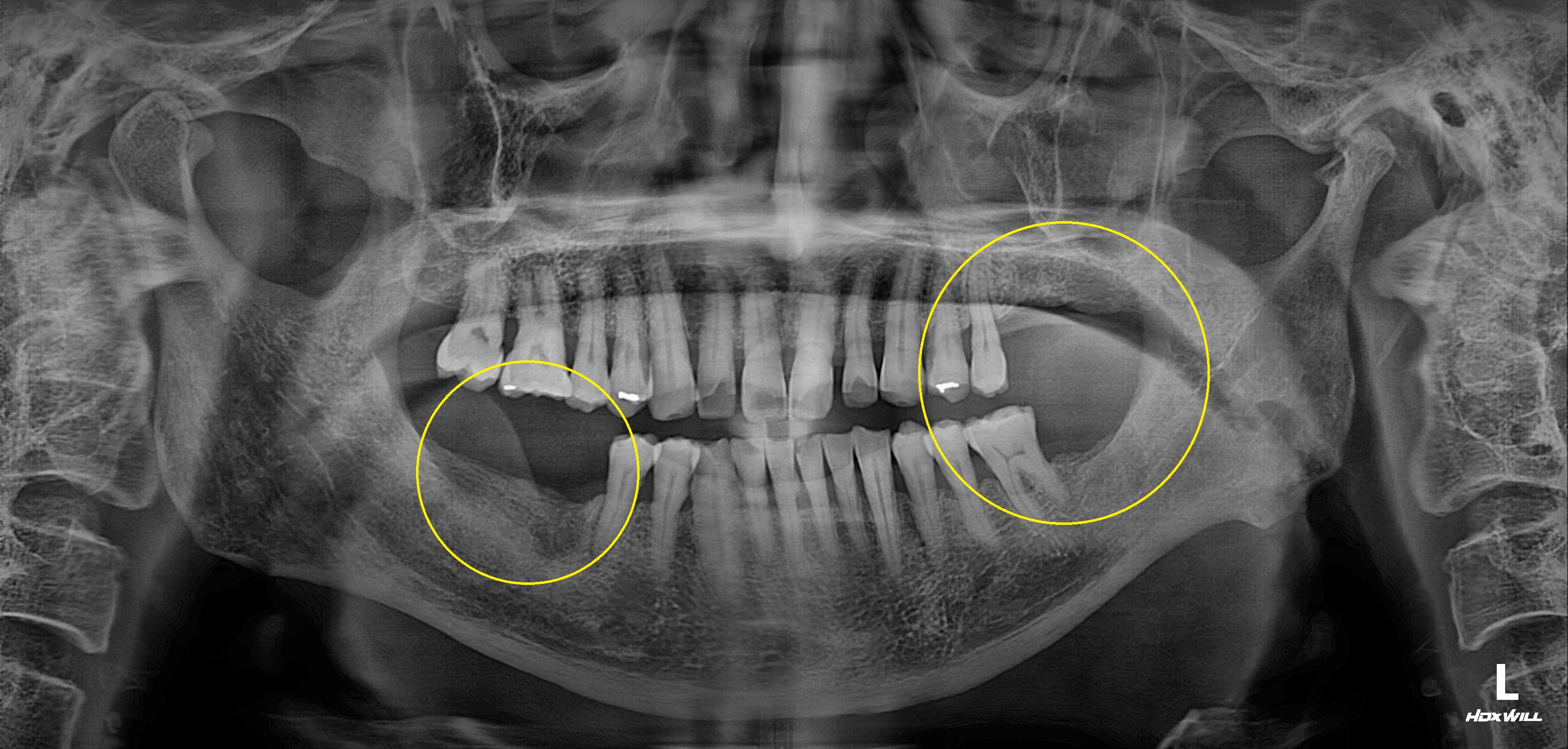 Before Image