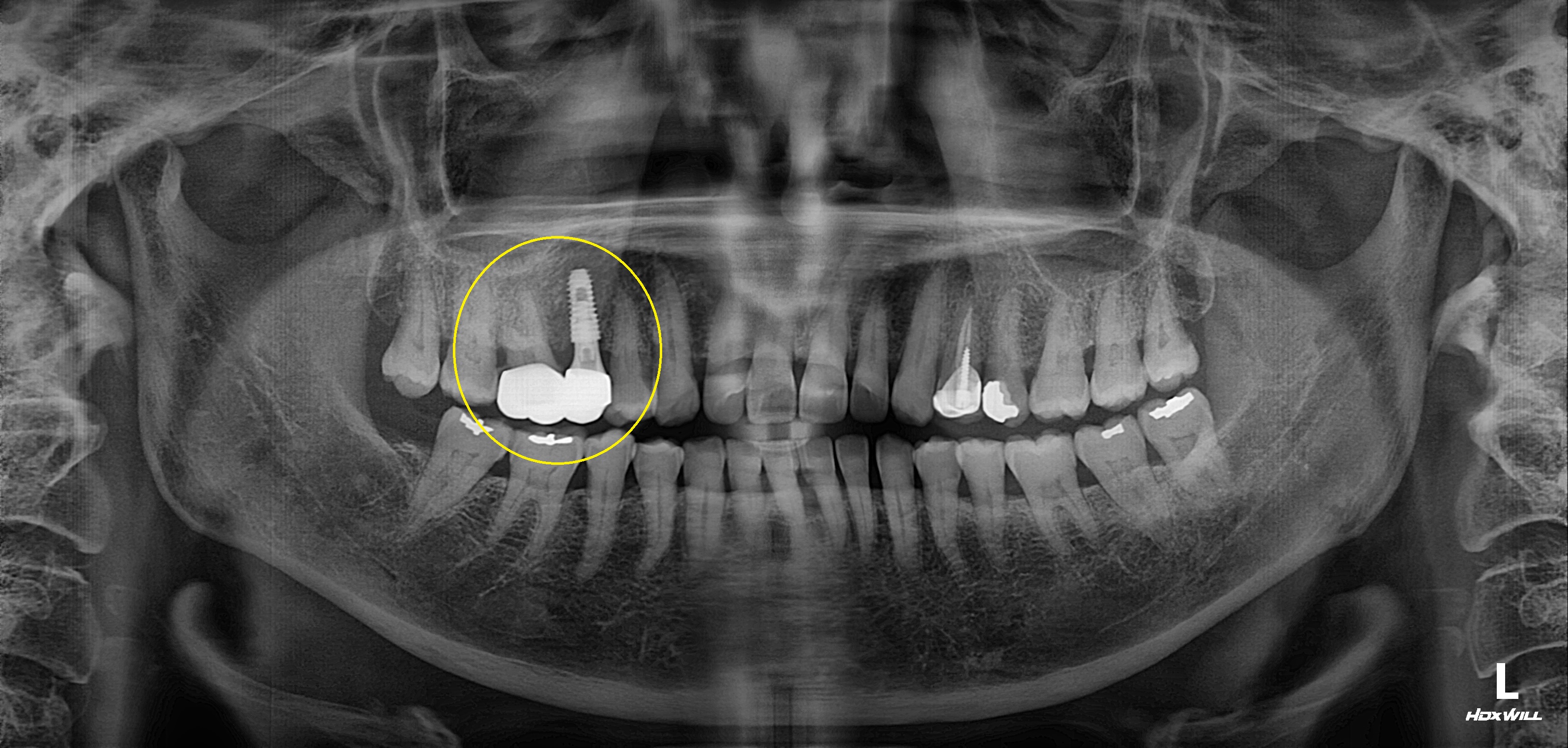 Before Image