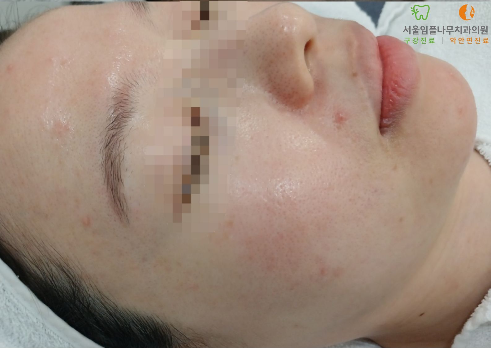 Before Image