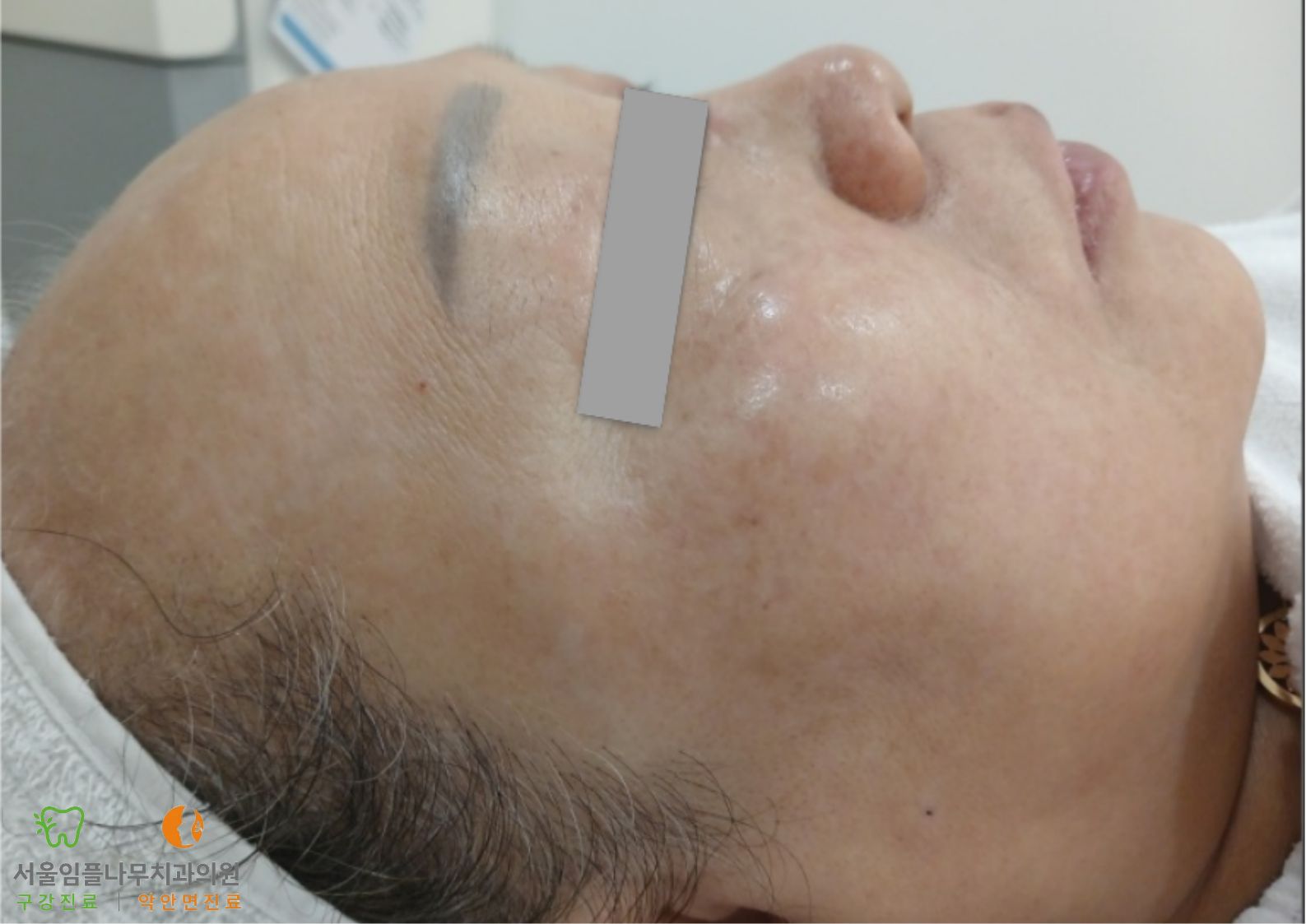 Before Image