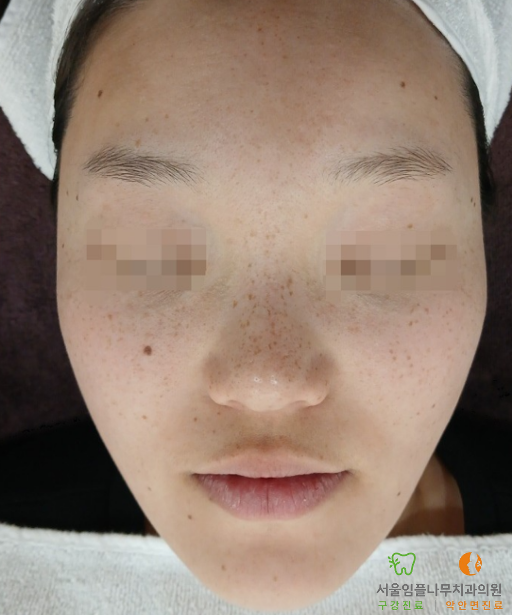 Before Image