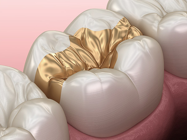 맞춤형 도포마취