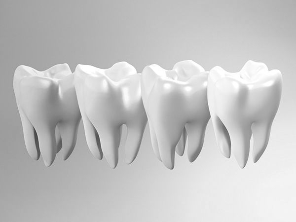 치아미백 심미치료