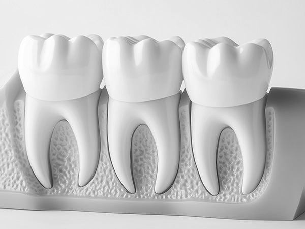 신경치료 자연치아살리기