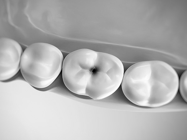 신경치료 자연치아살리기