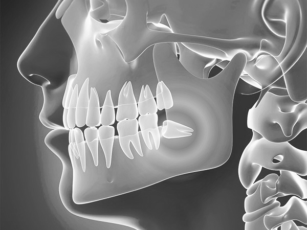 사랑니 악안면외과