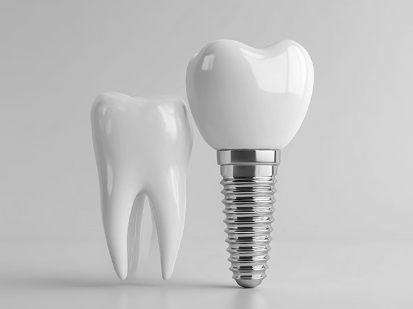 수면 임플란트 수면클리닉