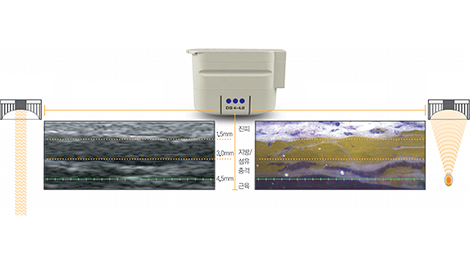 낭종,양성종양 악안면외과
